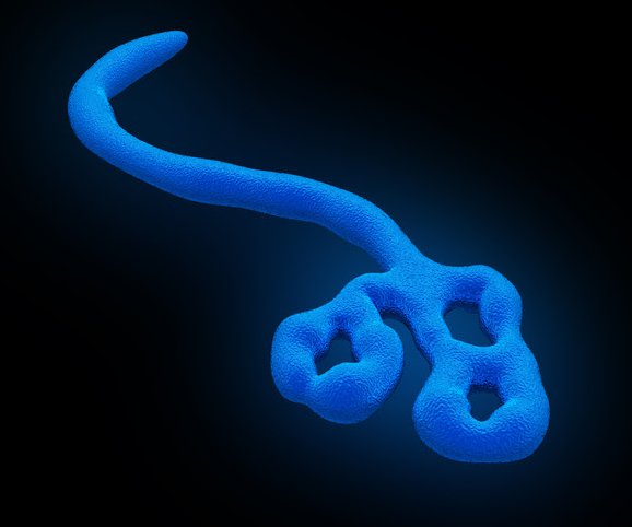 Ebola Virus